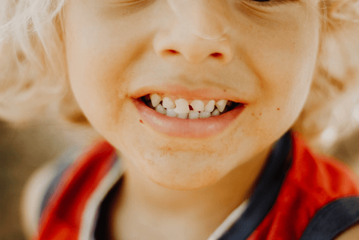 uśmiechnięta buzia dziecka z białymi ząbkami